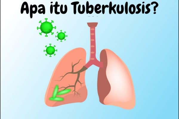 Apa itu Tuberkulosis?