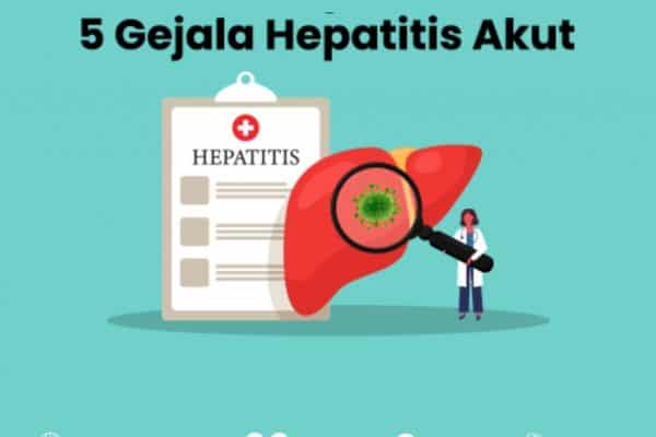 5 Gejala Hepatitis Akut